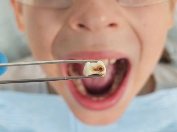 Best Emergency Pediatric Dentist  in Ralls, TX